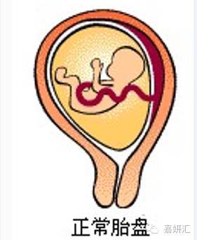关于孕妇胎盘,胎盘的十大知识