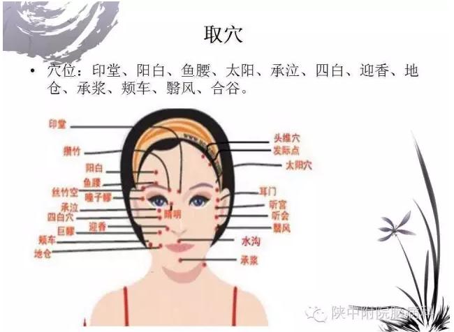 面神经炎的中医诊疗与中医护理