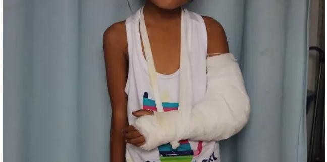 肱骨髁上骨折闭合复位手术记录,小儿肱骨髁上骨折手术恢复的概率