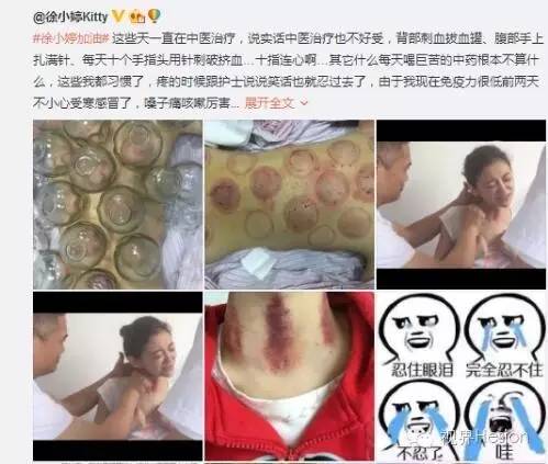 演员徐婷现在的状况,徐婷最后去哪了