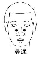 中医治疗过敏鼻炎一般多久见效,中医治疗过敏鼻炎