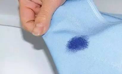 衣服腋下发黄怎么回事,衣服腋下发黄怎么洗