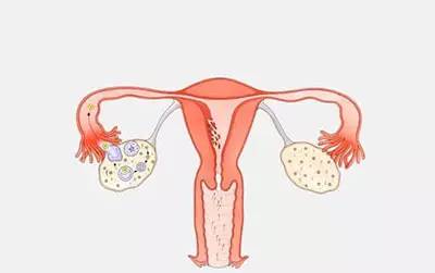 安了环还怀孕！怨我喽？