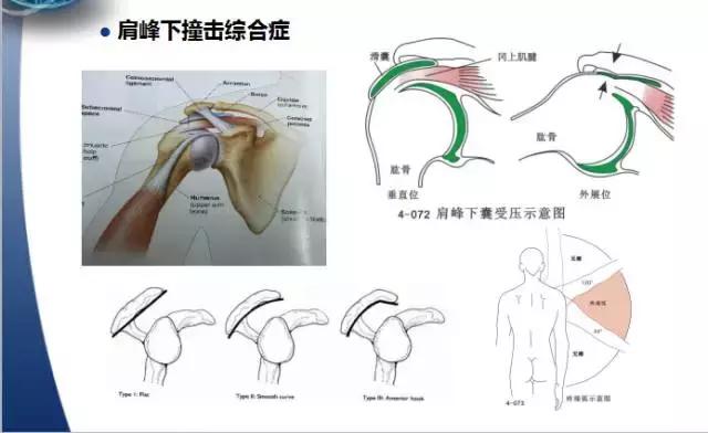 013医院,肩膀病怎么治疗最快最有效