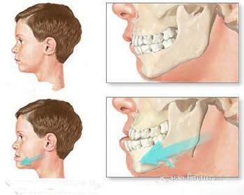 婴儿乳牙萌出关注事项,育儿必知道的营养小知识