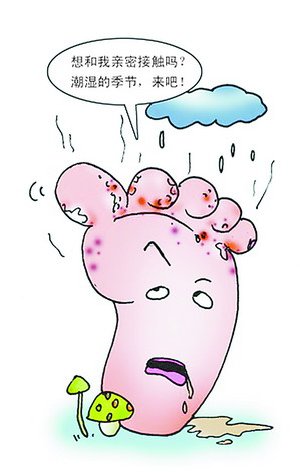 脚气脚臭脚痒便宜又好用的药,治脚气脚痒脚臭最有效的方法