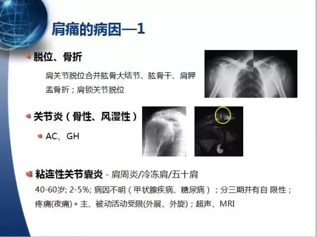 013医院,肩膀病怎么治疗最快最有效
