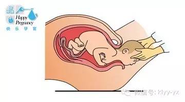 顺产胎儿是横位还是头位,分娩时胎头和骨盆关系