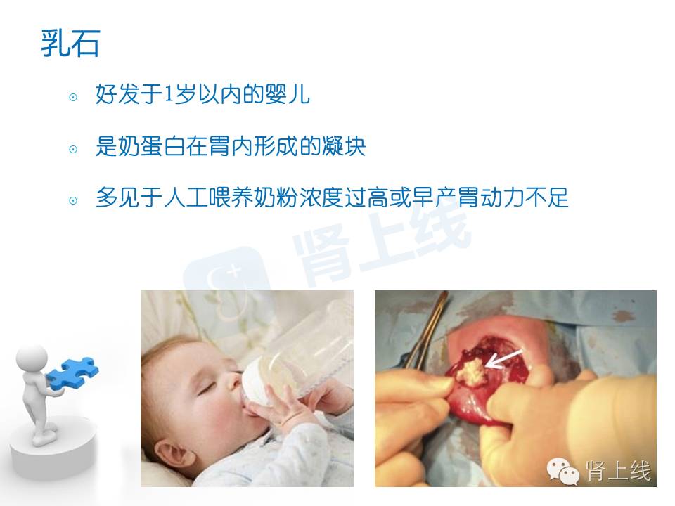 吃山楂取出胃结石,吃10个山楂胃结石有多少