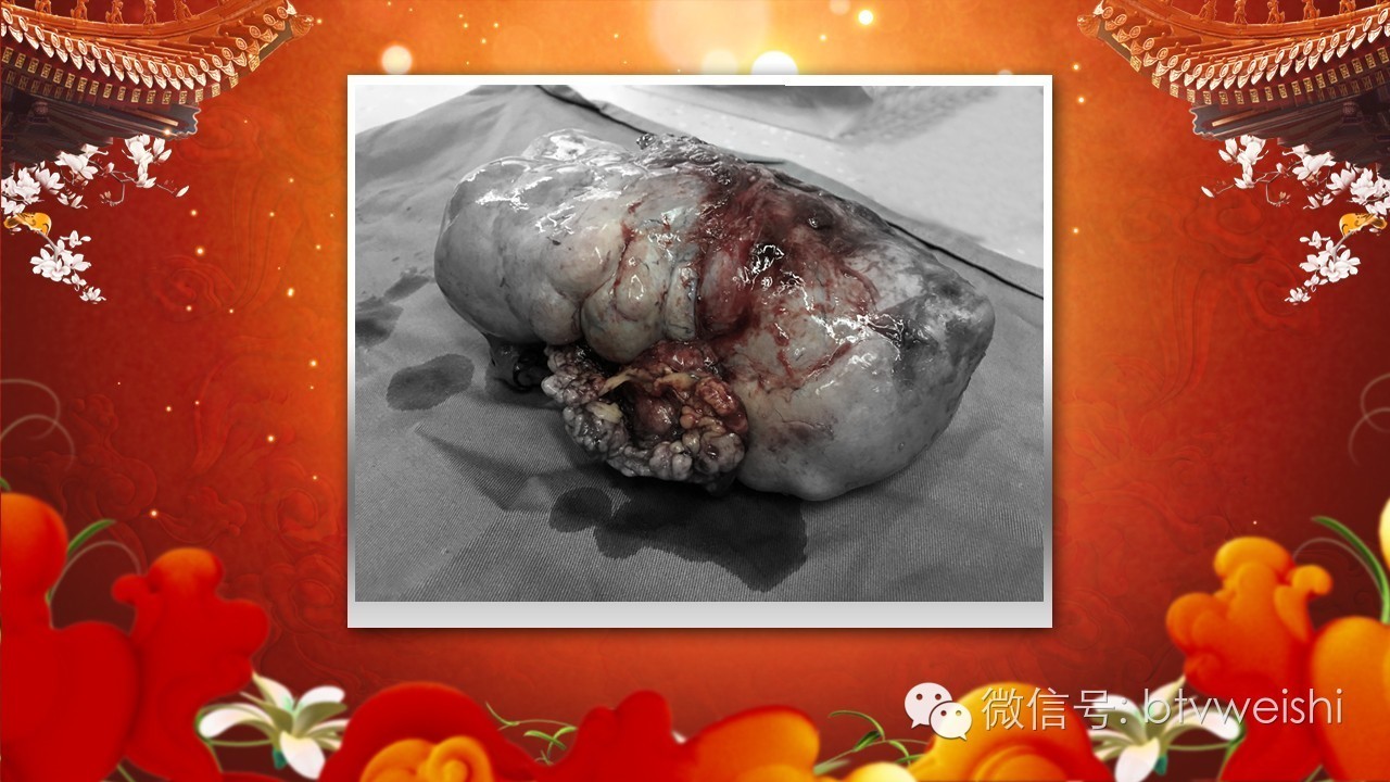 养生堂癌症,养生堂今日播出视频