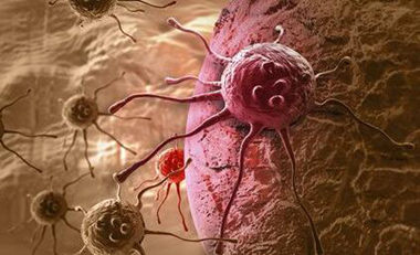 类风湿关节炎误区,类风湿的8大误区