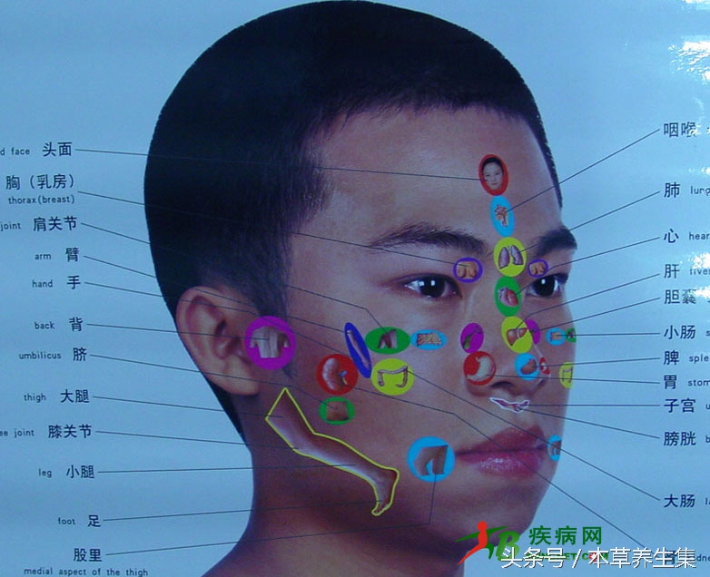 来大姨妈脸上起痘痘怎么办,痘痘来了