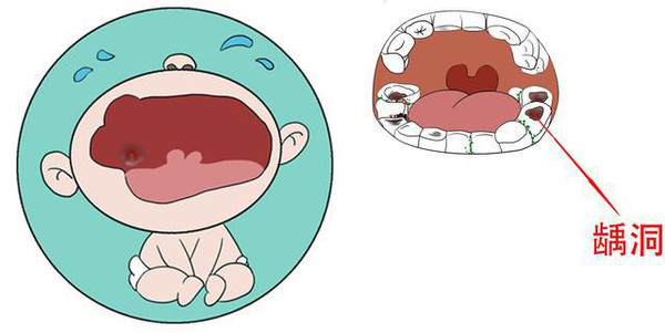 婴儿乳牙萌出关注事项,育儿必知道的营养小知识