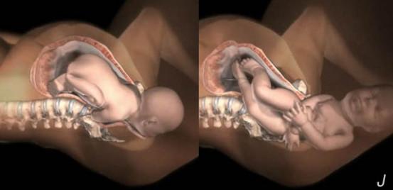 准备顺产的孕妈需要关注什么,顺产妈妈需要准备什么东西进产房