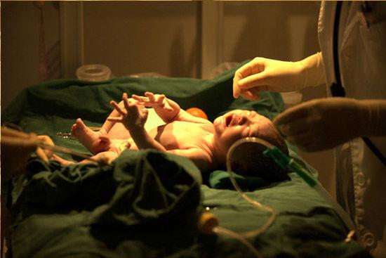 医院直击:产妇自然分娩全过程