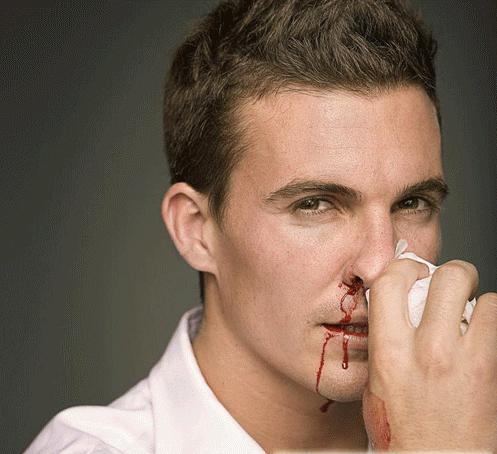 跑步流鼻涕吐痰是怎么回事,跑步流鼻血怎么回事