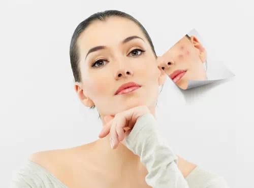 拯救爆痘肌肤,刷酸爆痘脱皮需要怎么办呢