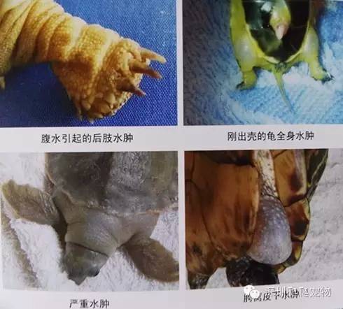 龟水肿的治疗方法,龟水肿是什么症状