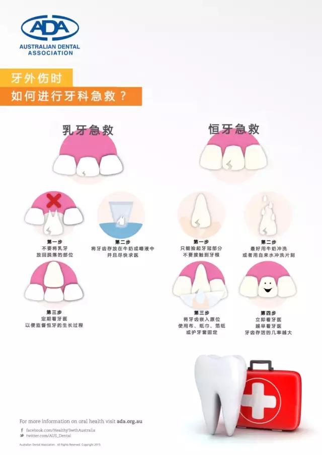 乳牙脱落时有哪些现象视频,拔乳牙视频全过程