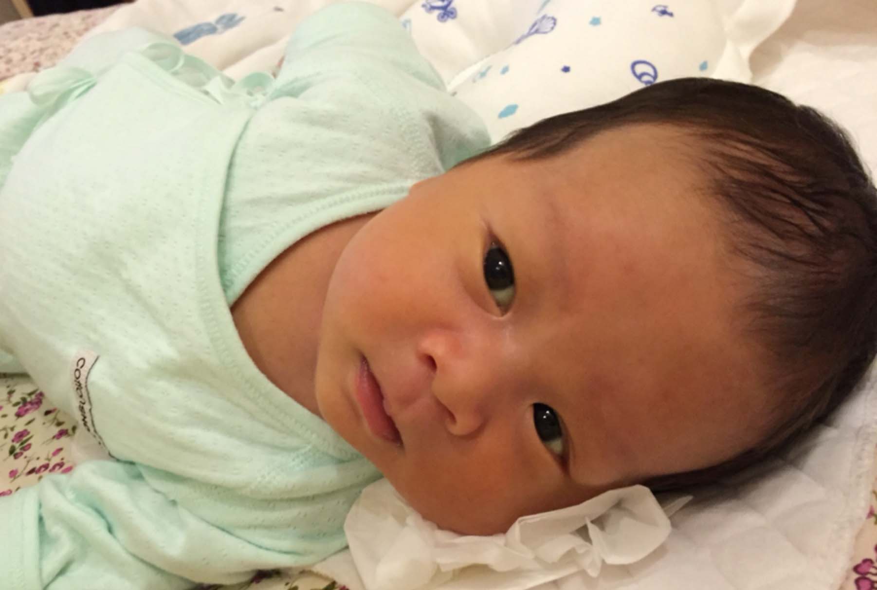 新生儿黄疸有哪些症状多久能退,新生儿黄疸一般出现哪几天