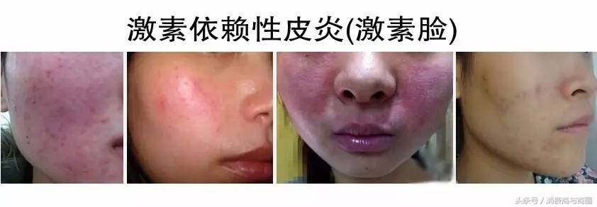 微商化妆品是不是都是骗人的,微商的护肤品还能买吗你怎么看