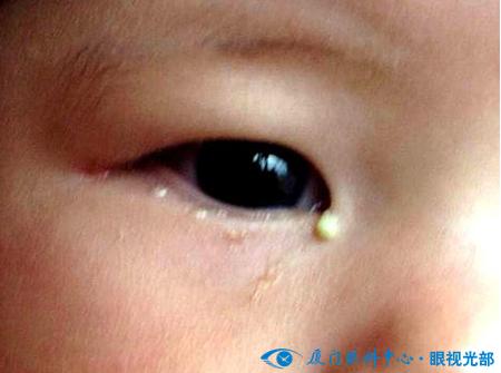 关于眼屎你还知道哪些知识,通过眼睛识人的口诀