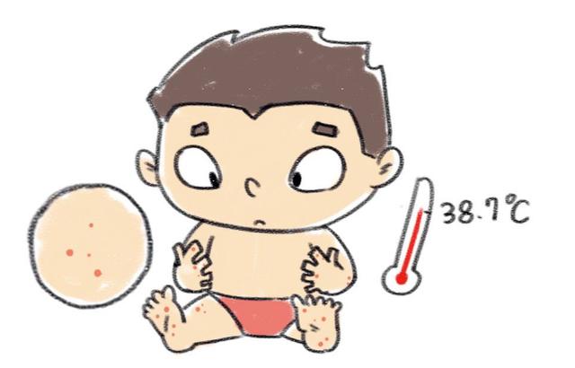 水痘疫苗和手足口病可以一起打吗,打了手足口疫苗还会得手足口病吗