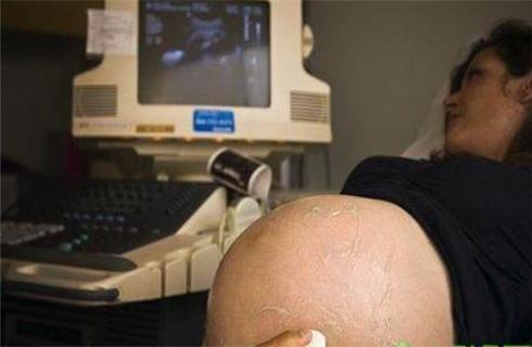 孕妇孕期症状关注事项,孕期常见的疾病有哪些