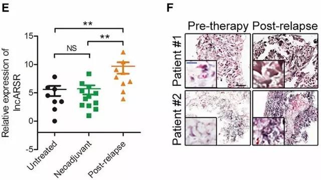 如何查找未知的lncrna序列,文献解读lncrna经典研究思路