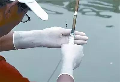 香虎烧手如何治疗的,香虎手能彻底治好吗