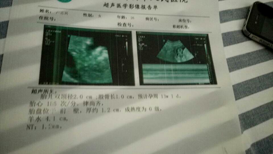 切完阑尾又切宫颈息肉，NT宝宝还是长得健健康康的