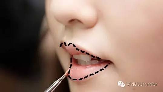 薄嘴唇可以做嘟嘟唇吗,厚嘴唇可以弄成嘟嘟唇吗