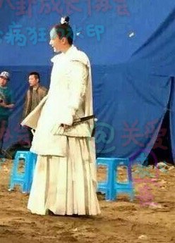 杨幂的发际线是怎么恢复的,杨幂发际线秃到后脑勺了