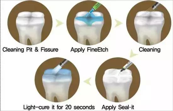 宝宝龋齿可能引发全身性疾病，妈妈必须知道的0~6岁牙齿护理