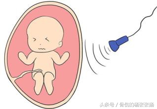 到底B超对胎儿有没有害