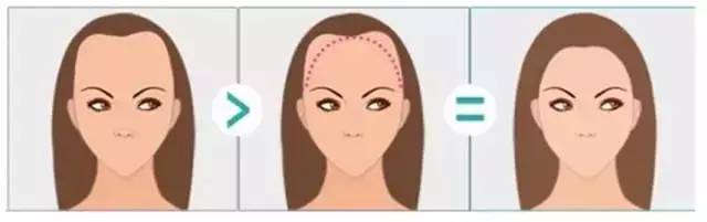 发际线决定人的智商,发际线决定气质