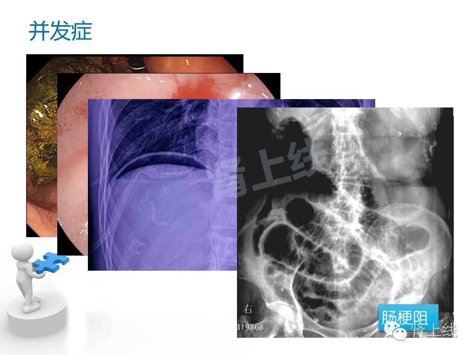 吃山楂取出胃结石,吃10个山楂胃结石有多少