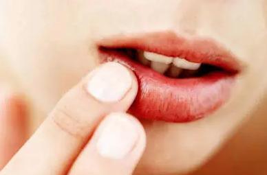 嘴唇干裂和接吻有关系吗,嘴唇干裂和胃有关系吗