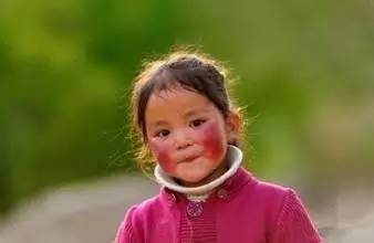 护肤怎么去红,用什么护肤品可以改善脸上红血丝