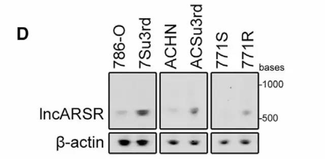 如何查找未知的lncrna序列,文献解读lncrna经典研究思路