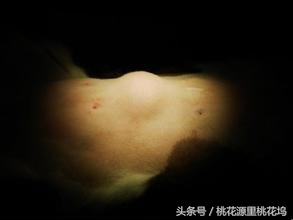 如果长了脂肪瘤怎么办？憋激动，淡然除之