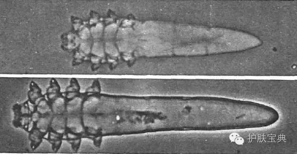 有螨虫的皮肤该怎么处理,螨虫真的和皮肤没有关系吗