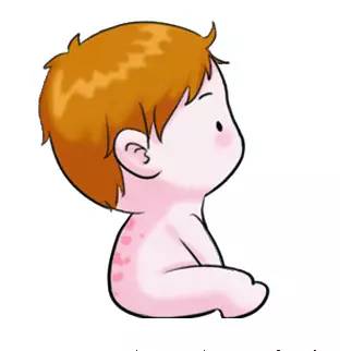 宝宝身上有哪些胎记,有胎记的小孩儿是不是天使