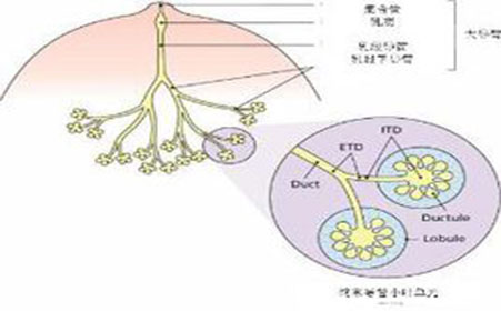 乳腺纤维瘤刺痛是怎么回事,什么是乳腺纤维腺病