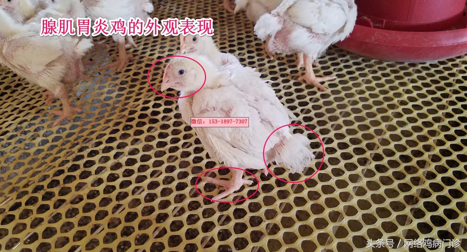 腺肌症治愈的病例分享,鸡腺肌胃炎的治疗成功案例