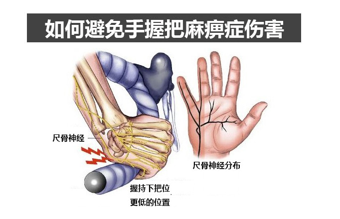 骑行手掌疼,骑行裆部麻木
