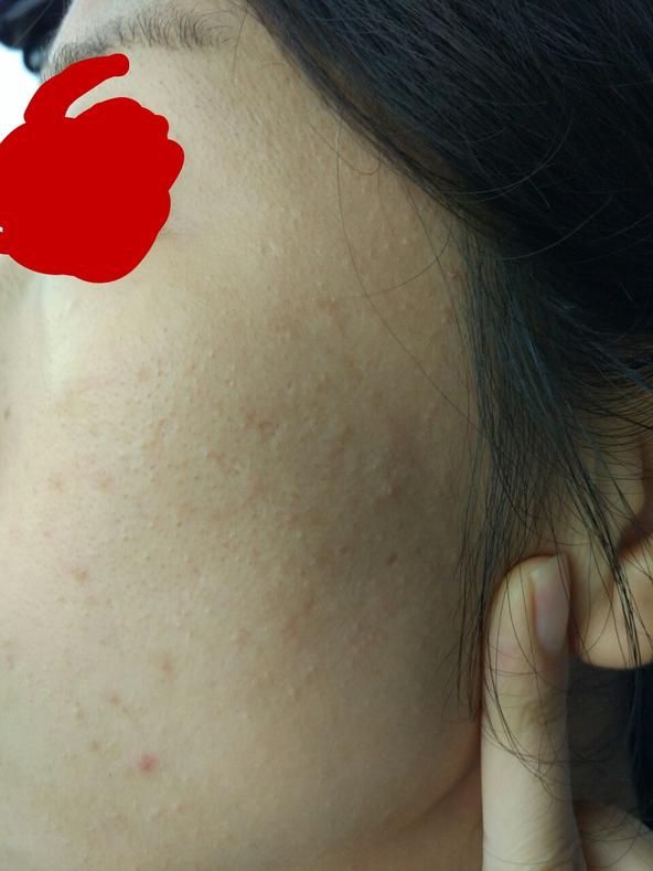 护肤一百问答,女孩健身护肤知识问答