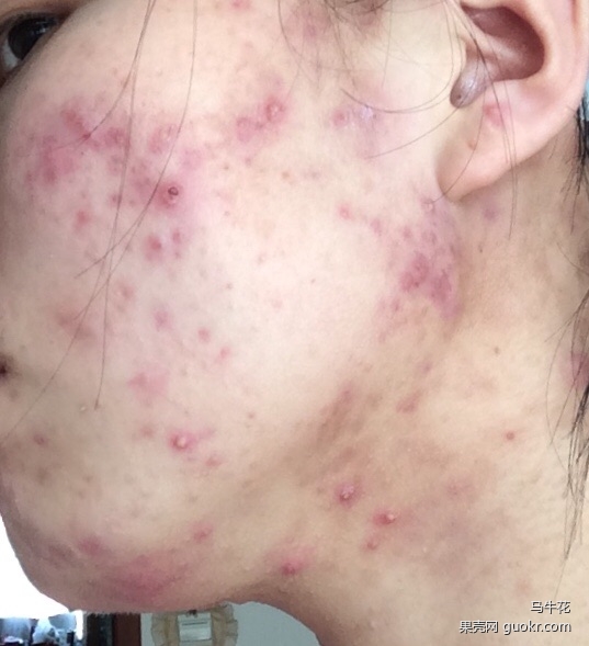 护肤一百问答,女孩健身护肤知识问答