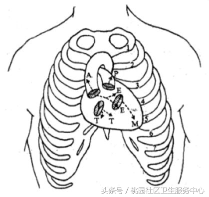 听诊器小朋友听心跳,听诊器听心脏儿童