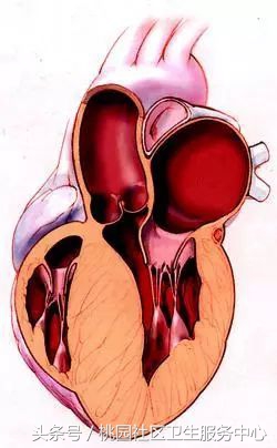 心脏支架说明书,这份通俗易懂的心脏说明书请收好
